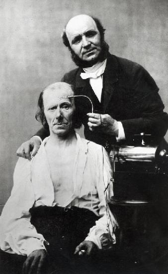 Duchenne de Boulogne with a ''victim patient'', 1862 (b/w photo) 